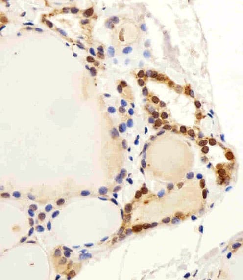 FAM216B Antibody (aa106-139)