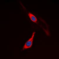 Polyclonal Rabbit anti-Human CSF1R / CD115 / FMS Antibody (Internal, IF, WB)