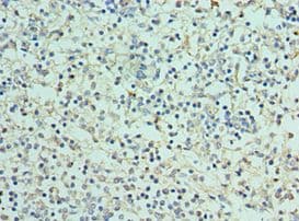 CLEC12A / CD371 Antibody (aa66-265)