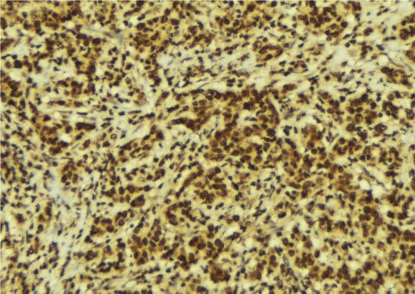 CSRP1 Antibody