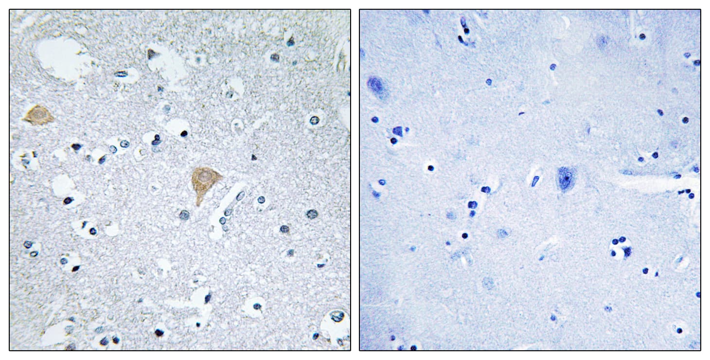 Polyclonal Rabbit anti-Human CIT / CRIK / Citron Antibody (aa1011-1060, IHC, IF)