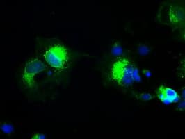 Prominin 2 / PROM2 Antibody (clone OTI5E5, Carrier-free)