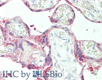 SERPINB2 / PAI-2 Antibody (Internal)