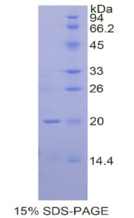 Human IHH Protein (Recombinant His)