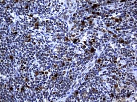 Monoclonal Mouse anti-Human PCNA Antibody (clone OTI1D11, IHC, WB)