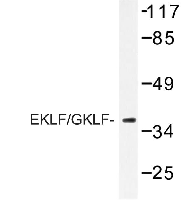 Polyclonal Rabbit anti-Human EKLF / KLF1 Antibody (Trp318, IF, WB)