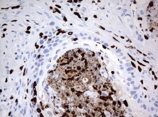 PBX1 Antibody (clone UMAB110)