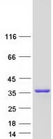 Human DOHH Protein (Recombinant Myc-DDK (Flag))
