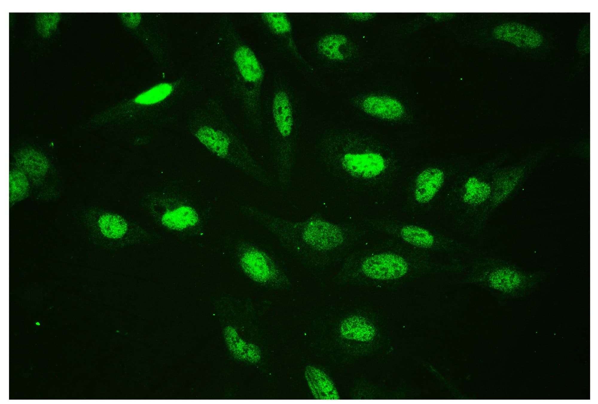 CTBP2 Antibody (aa321-445)