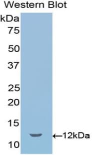 SEMA3E / Semaphorin 3E Antibody (aa581-669, APC)