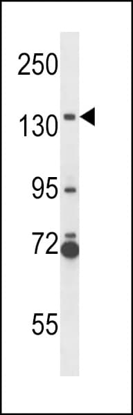 NOS2 / iNOS Antibody (aa108-138)