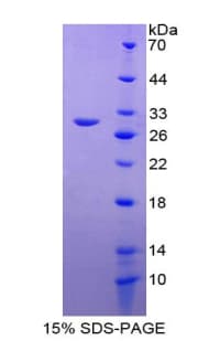 Mouse IGFBP4 Protein (Recombinant His-T7)