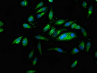 PNPLA6 / NTE Antibody