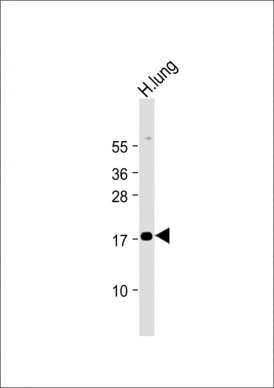 IHC-plus™ Polyclonal Rabbit anti-Human RARRES2 / Chemerin Antibody (N-Terminus, IHC, IF, WB)