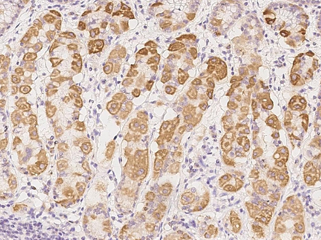 Polyclonal Rabbit anti-Human COMTD1 Antibody (IHC)