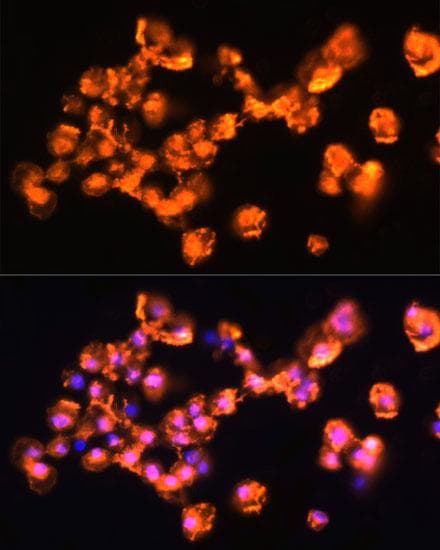 PRKCB / PKC-Beta Antibody
