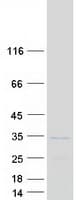 Human RPL8 / Ribosomal Protein L8 (Recombinant Myc-DDK (Flag))