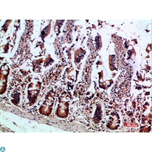 IL12B / IL12 p40 Antibody