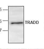 IHC-plus™ TRADD Antibody