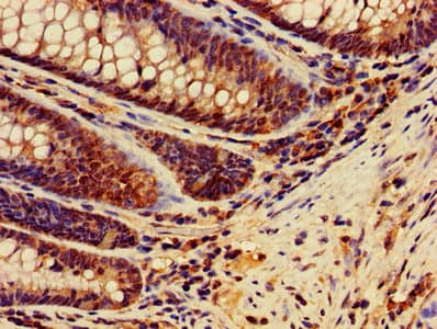 Polyclonal Rabbit anti-Human MSH2 Antibody (WB)