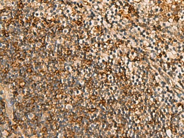 HORMAD2 Antibody