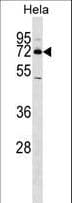 Polyclonal Rabbit anti-Human NR4A2 / NURR1 Antibody (aa13-42, IHC, IF, WB)