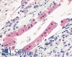 PathPlus™ Polyclonal Rabbit anti-Human AVPR1B Antibody (Cytoplasmic Domain, IHC)