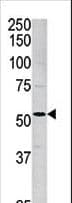 ALK2 / ACVR1 Antibody (aa85-123)