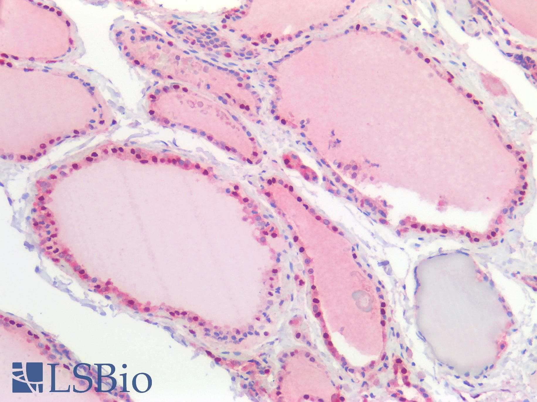 IHC-plus™ Polyclonal Rabbit anti-Human NEDD8 Antibody (IHC)