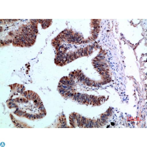 Polyclonal Rabbit anti-Human YARS / Tyrosyl-tRNA Synthetase Antibody (WB)