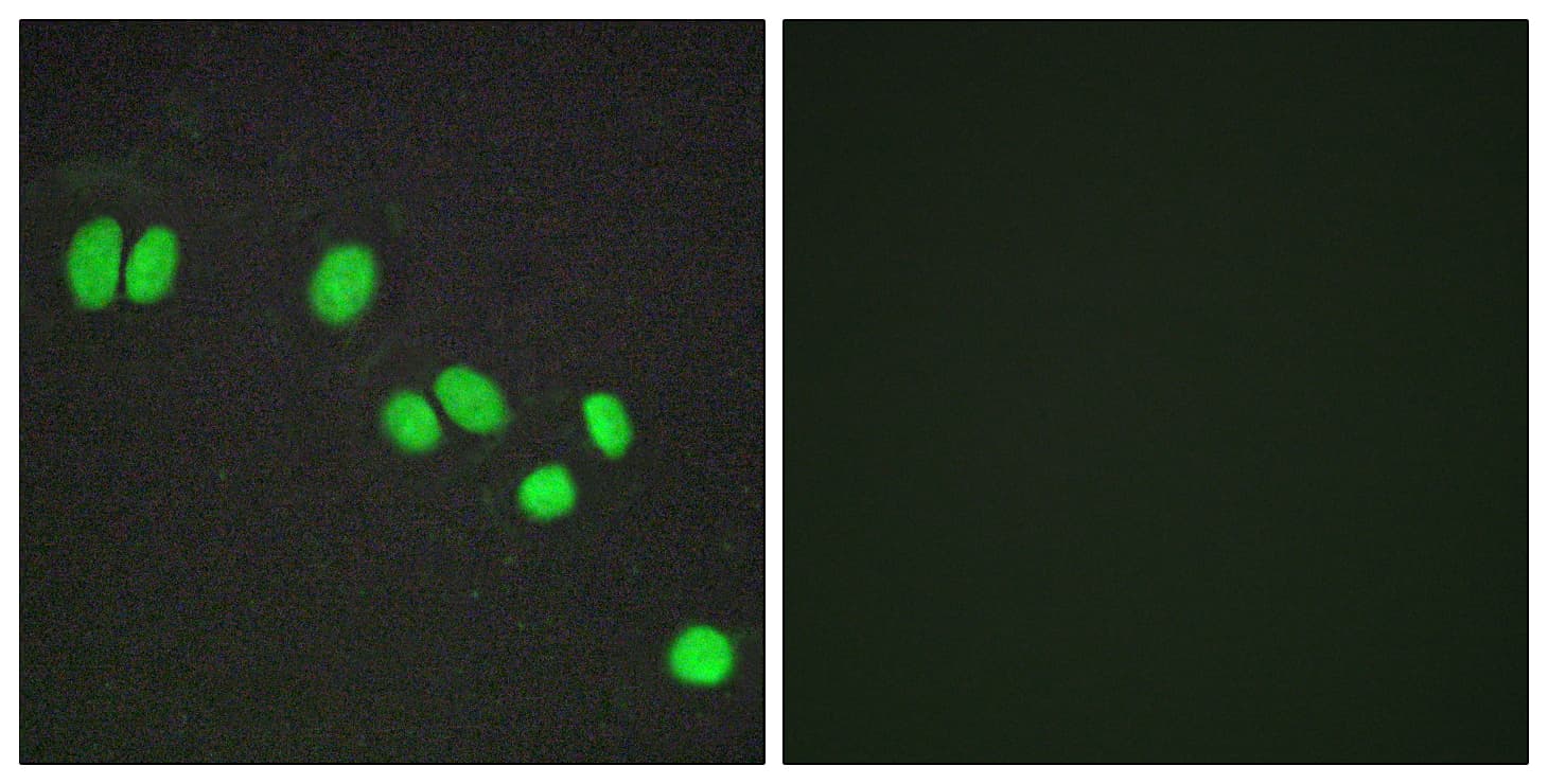 NCOR2 / SMRT Antibody (aa511-560)