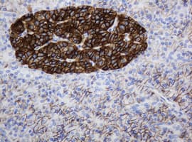 CD99 Antibody (clone OTI4E1)