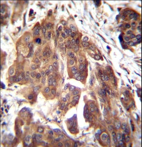 GLMN Antibody (aa498-525)