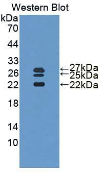 IL1RN Antibody