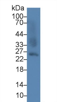 GSTA2 Antibody (aa1-222, PE)