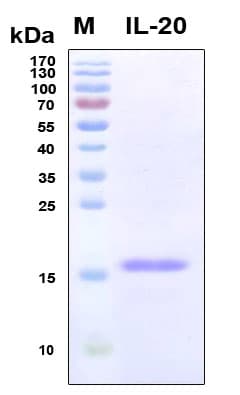 Human IL20 Protein (Recombinant 6His, N-terminus)