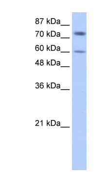 CRD-BP / ZBP1 / IGF2BP1 Antibody (aa155-204)