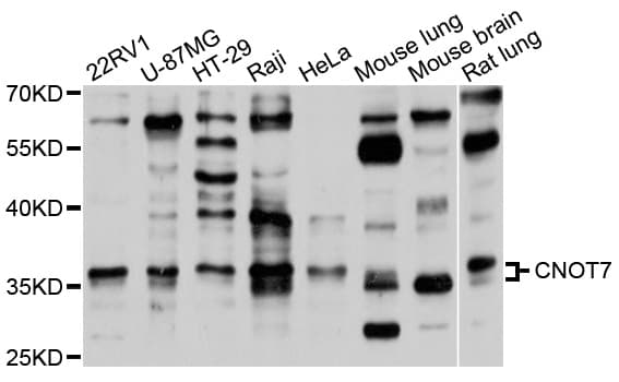 Polyclonal Rabbit anti-Human CNOT7 Antibody (WB)