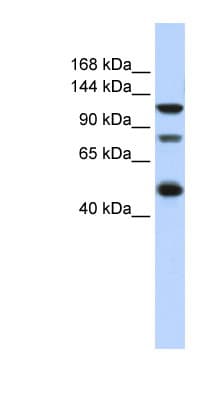Polyclonal Rabbit anti-Human ZEB2 / SIP-1 Antibody (C-Terminus, IHC, WB)