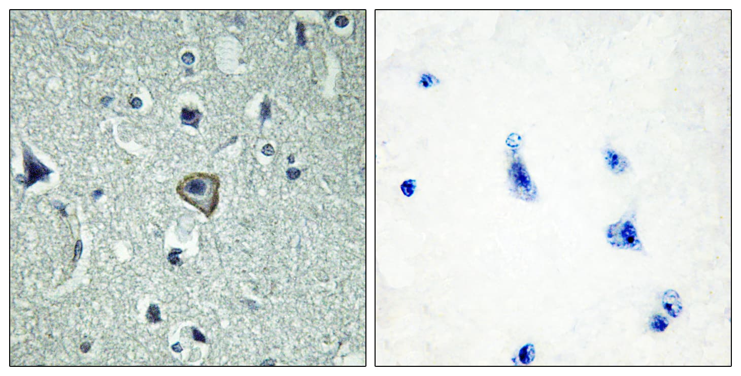 ADGRB2 / BAI2 Antibody (aa91-140)