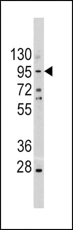 CDH1 / E Cadherin Antibody (aa833-862)