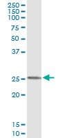 Monoclonal Mouse anti-Human FXN / Frataxin Antibody (clone 1D9, WB)