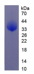 Human NOTCH4 Protein (Recombinant His-T7)