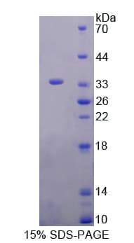 Human GRK4 Protein (Recombinant His-T7)