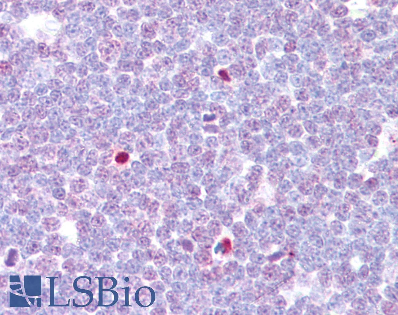 IHC-plus™ Polyclonal Rabbit anti-Human CAMK4 / CaMK IV Antibody (aa166-215, IHC, IF, WB)