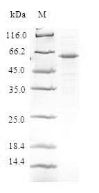 Human DEDD Protein (Recombinant GST, N-terminus)