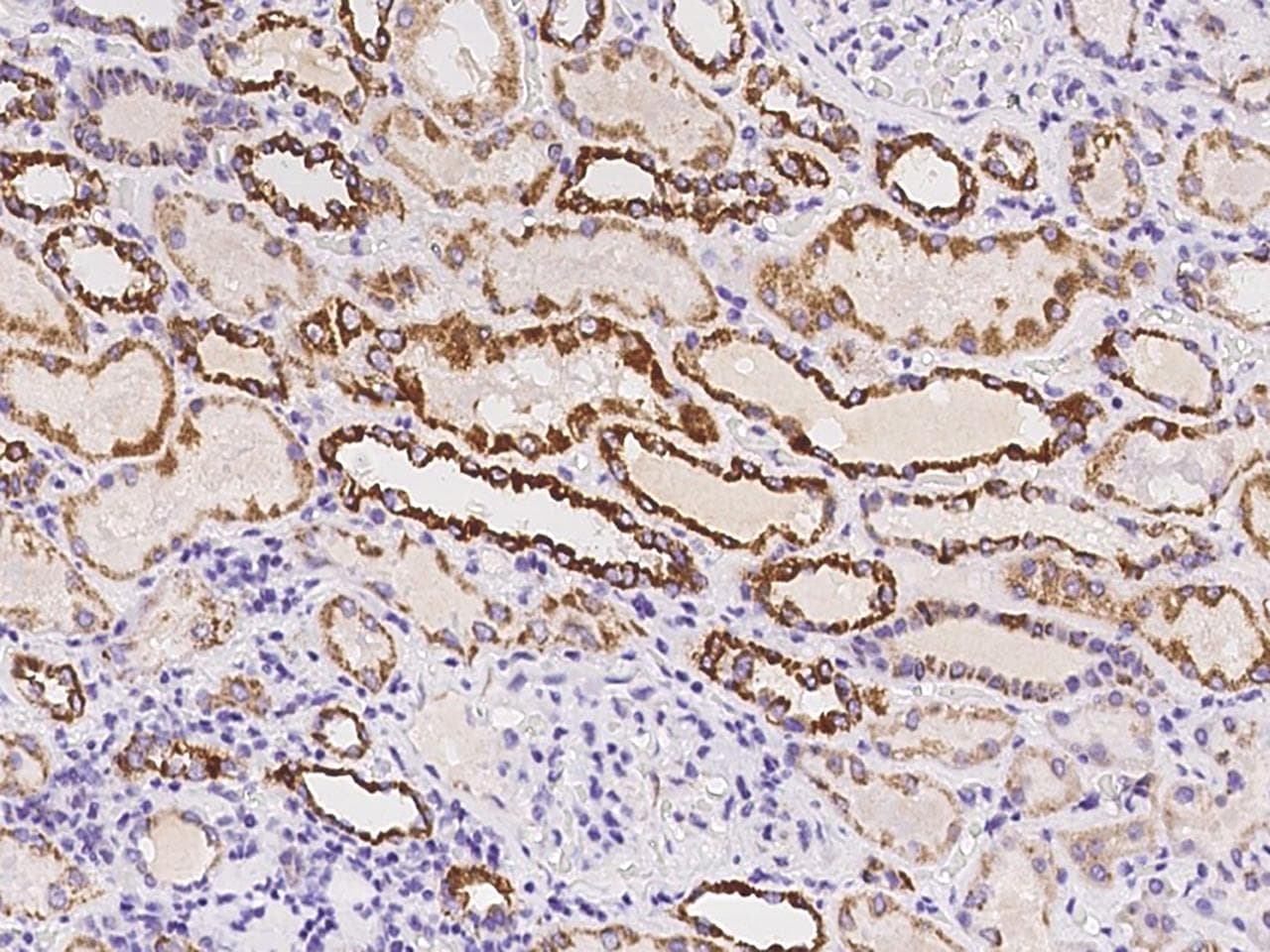 TIMM8A Antibody
