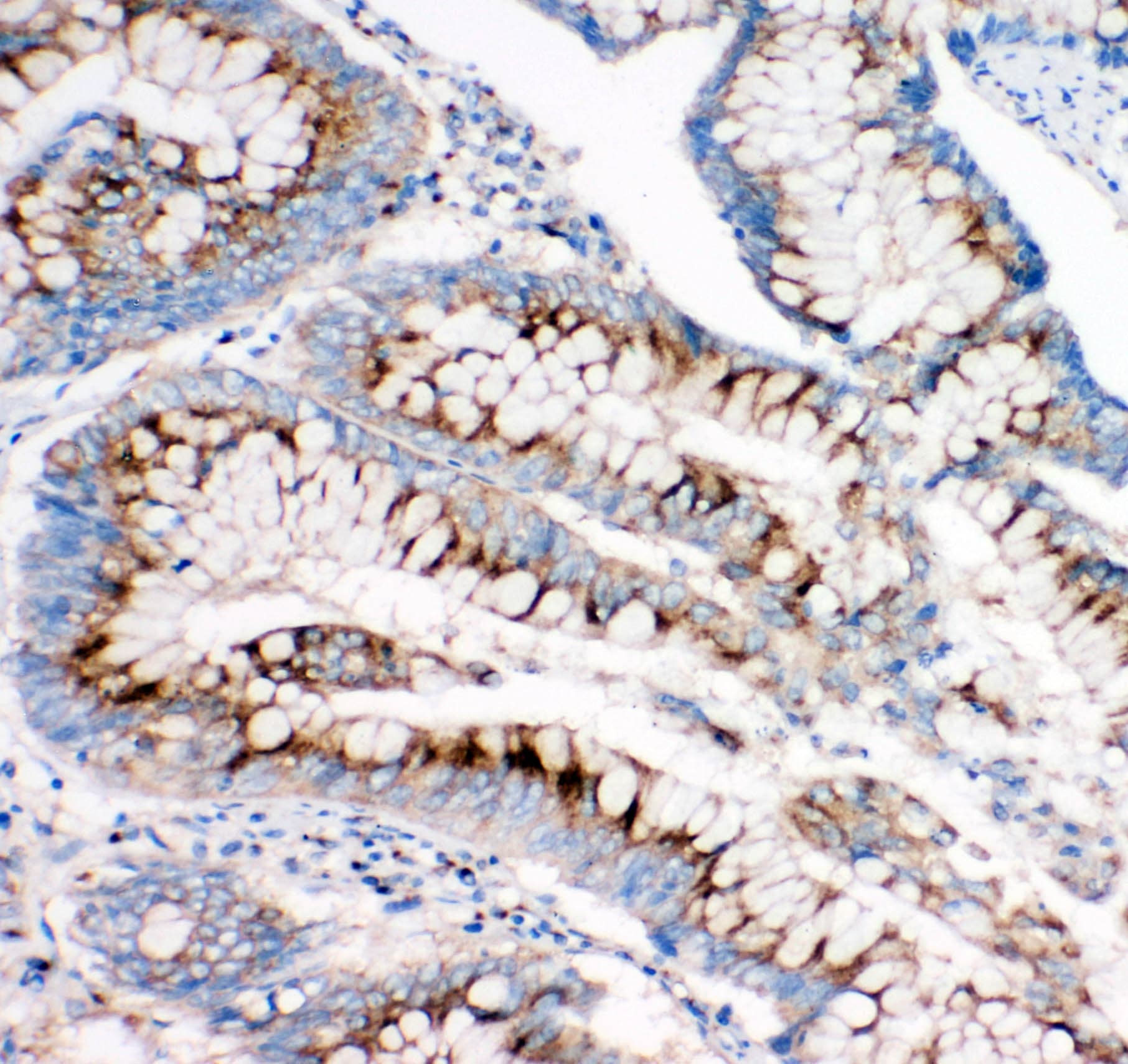 Polyclonal Rabbit anti-Human IGF2R / CD222 Antibody (aa2475-2491, IHC, WB)