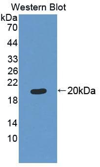 BM022 / MRPL1 Antibody (aa147-285)