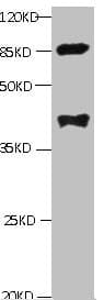 LP-PLA2 / PLA2G7 Antibody (clone 2A1B6)